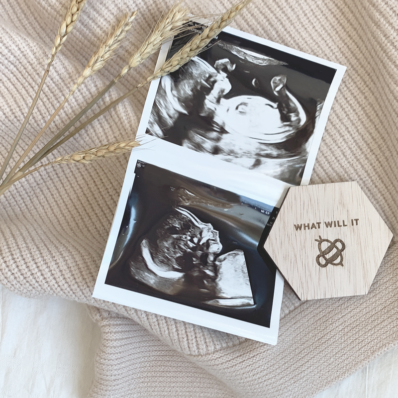 Gender Reveal Board